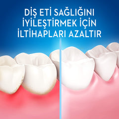 Oral-B Diş Fırçası Ultra Thin Kompakt Hassas Diş Eti Bakımı Ekstra Yumuşak Siyah